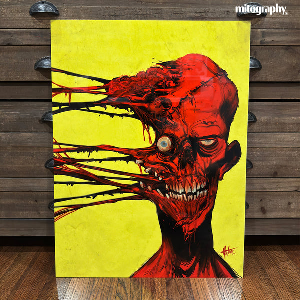 David Hartman - Allergy Season Metal Print